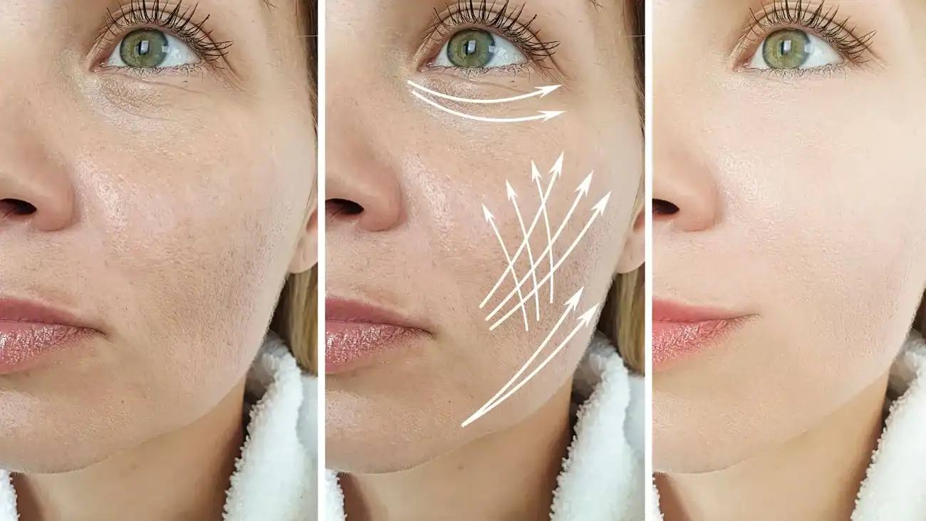 Can One Treatment Really Tackle More Than One Skin Concern Havering?